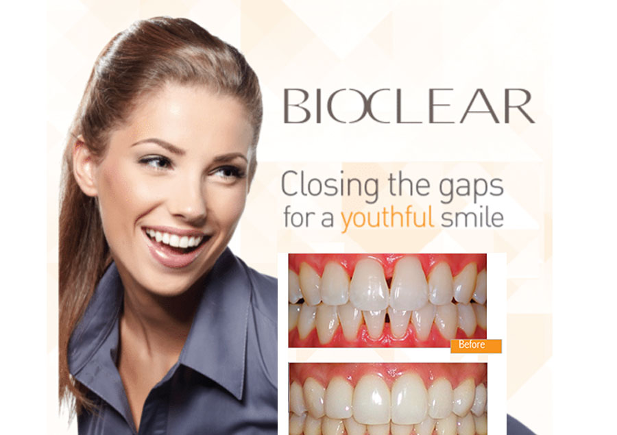 Bioclear Dentist in Las Vegas, NV