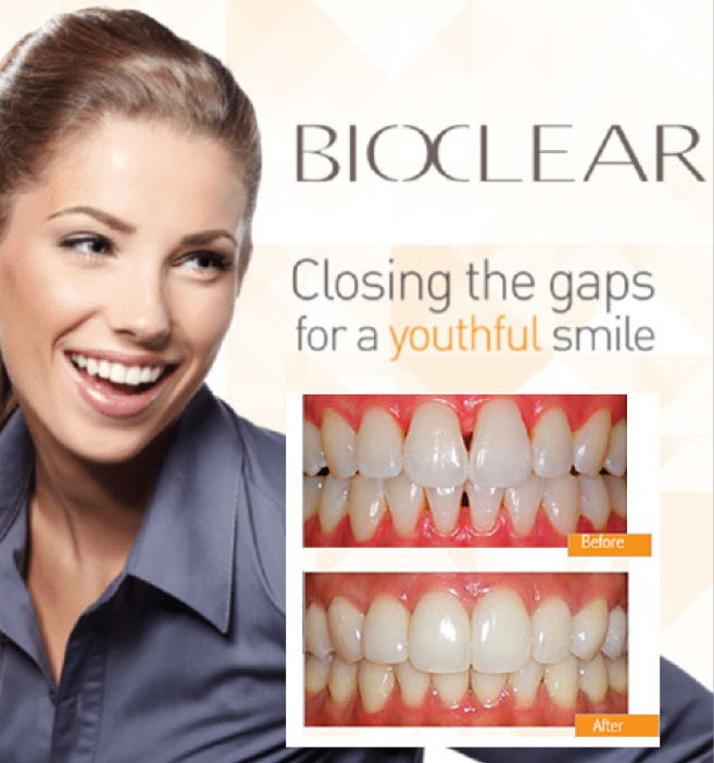 Bioclear Dentist in Las Vegas, NV