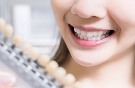 Teeth Whitening in Las Vegas, NV - Prime Care Dental 